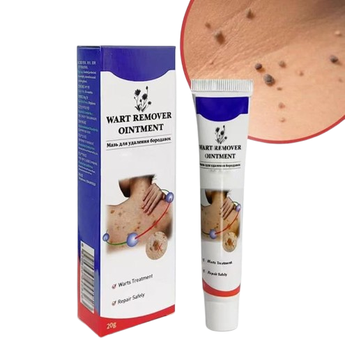 Wart Remover cream