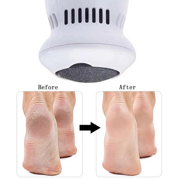 Electric Callus Remover